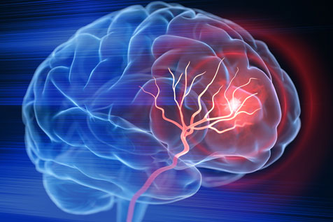 Epilepsy Neurologist